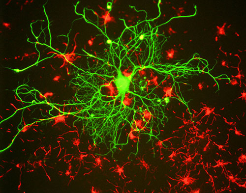 Engenharia neuromórfica